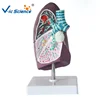Advanced Plastic 2/3 life-size Pathological pulmonary anatomical lung system disease lung system disease