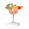 Anatomical human pancreas pathology model for teaching