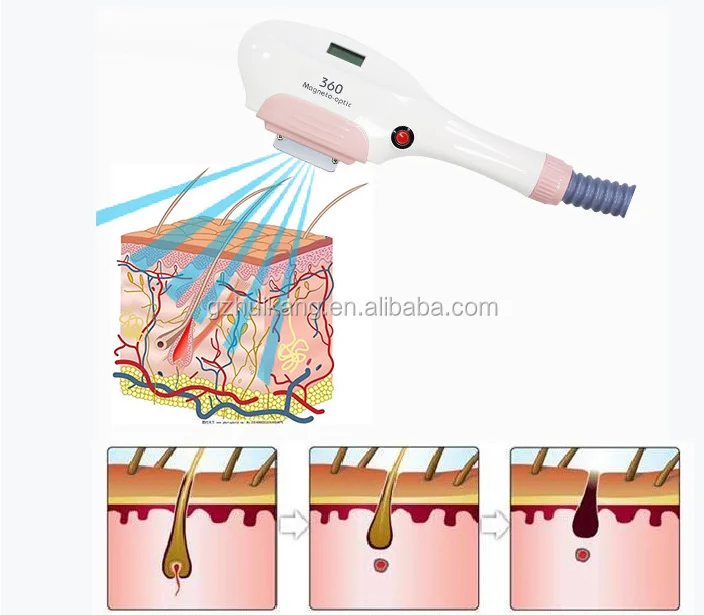 ipl opt shr hair removal hair removal machine