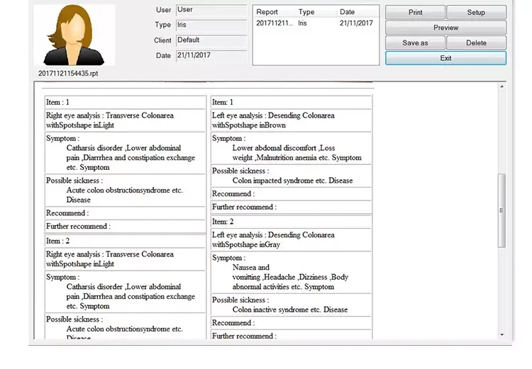 iriscope camera (5).png