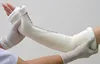 Rapid Ossification (Concretion) Orthopedic Water Activated Polyurethane Resin Sleeve Cast Tape