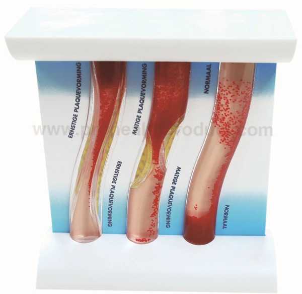 PH4220 Blood Vessel Model(Liquid filled)