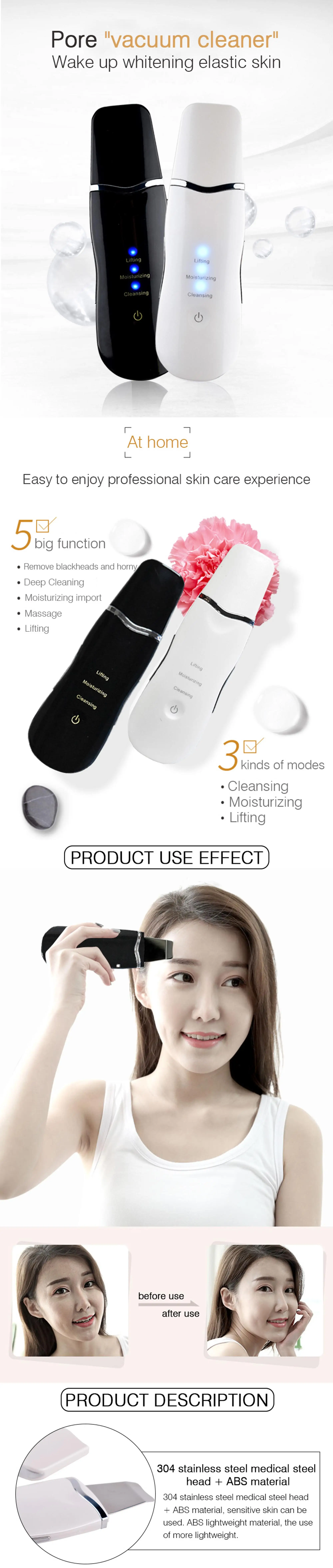 Midom Beauty Trade Assurance Wholesale Dry Face Ultrasonic Scrubber