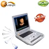 Innovative technology 3D laptop ultrasound machines with high quality