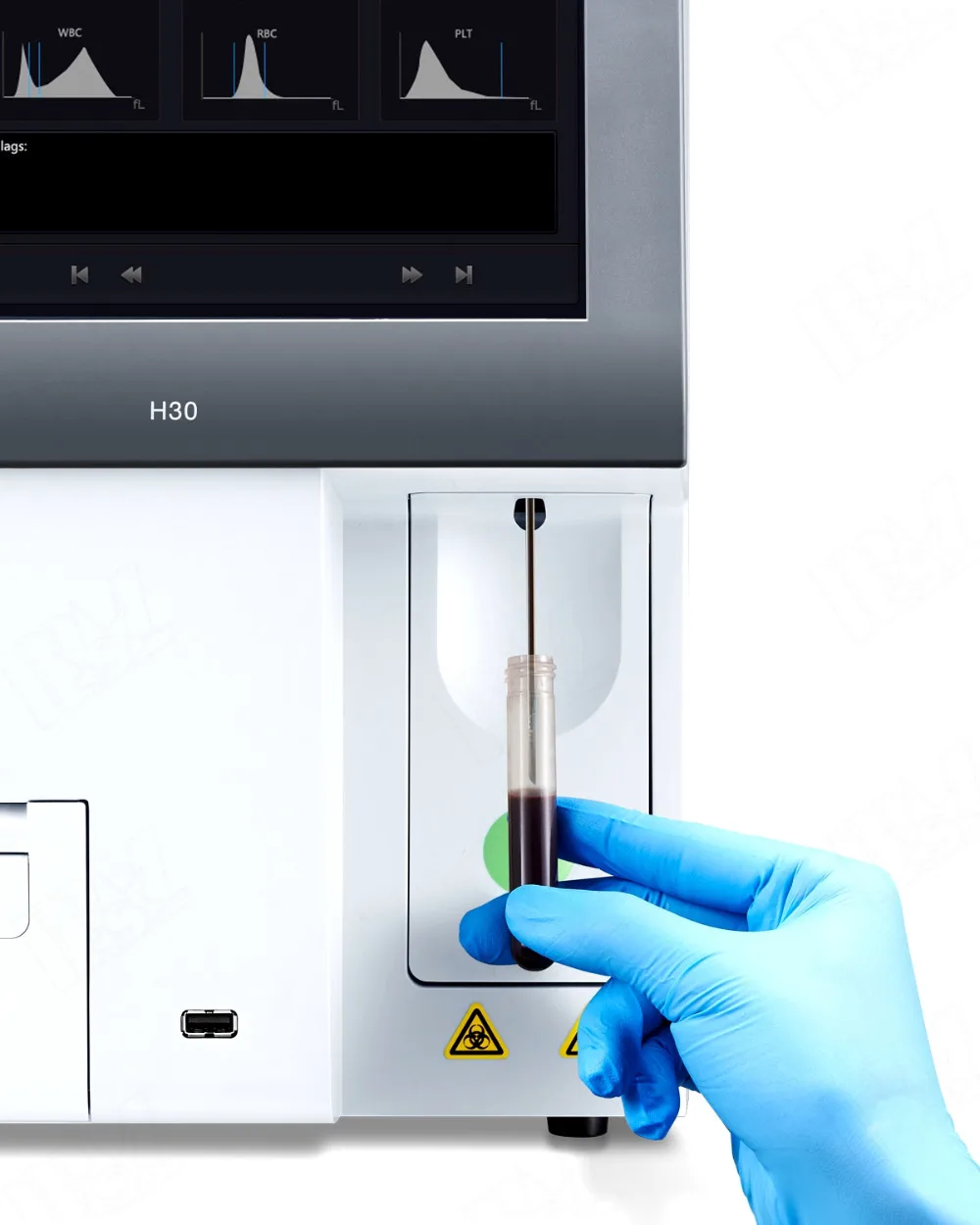 Lab Blood Testing Machine/fully Automatic 3part Hematology Analyzer