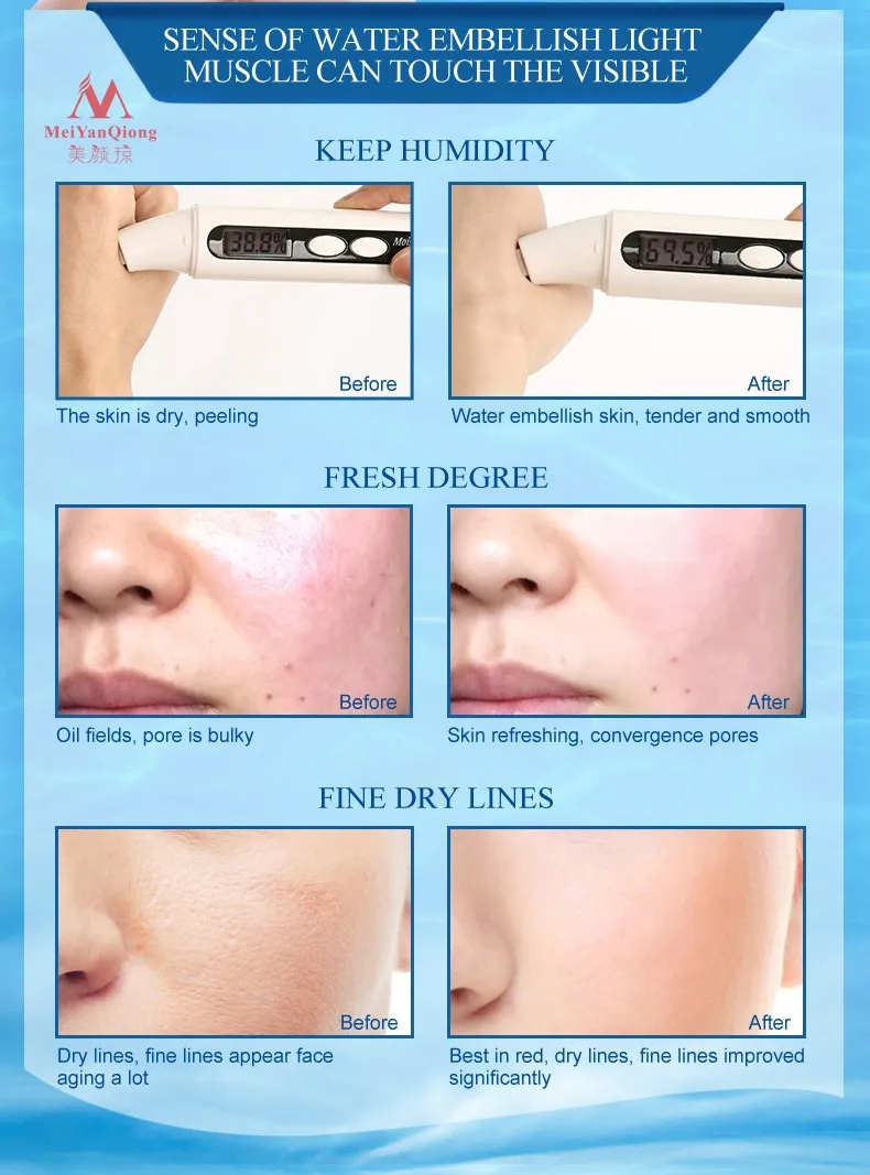 meiyanqiong tender brightening and moisturizing cream