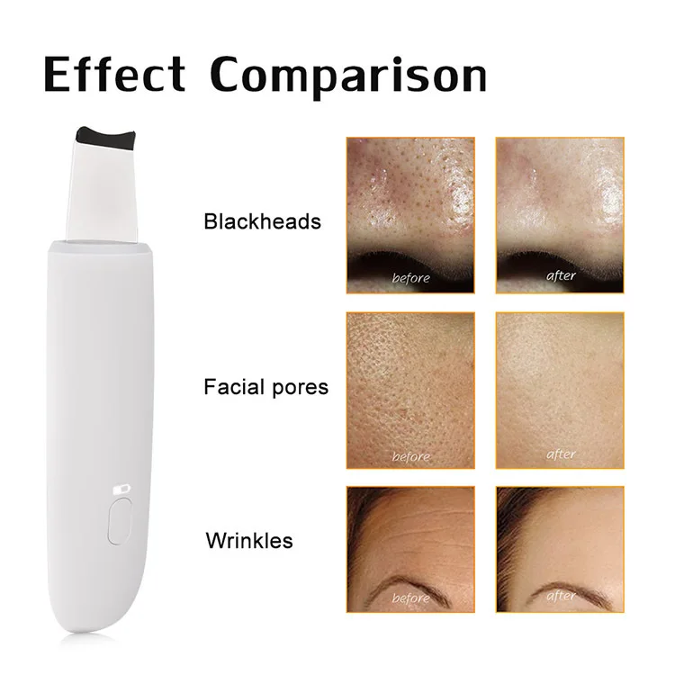 deep cleansing machine (7).jpg