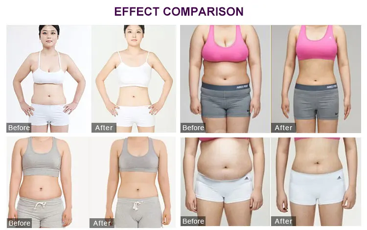 beauty personal care Vacuum +Vela body shape+Roller Massager + RF System Newest Slimming Machine