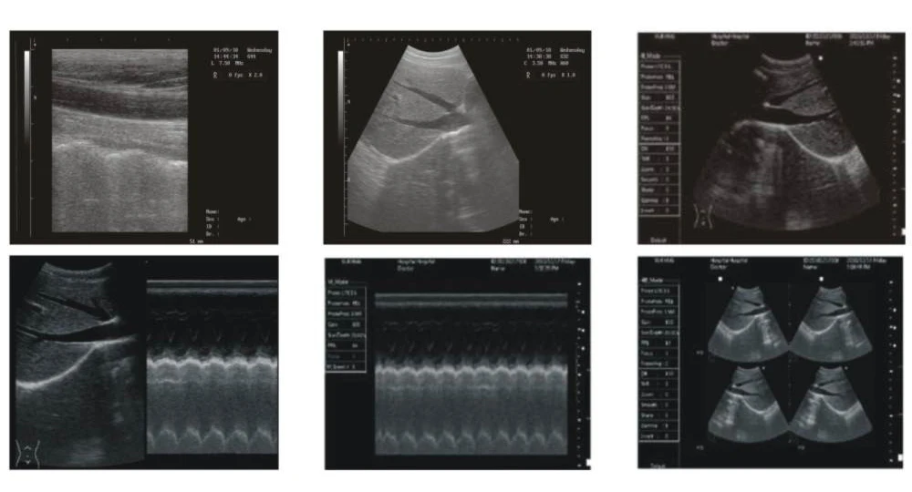 SA51353A LCD vet -24.JPG