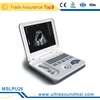 MSLPU26T Versatile functional 3D ultrasound machine/scanner multi frequency USB probes for OB,GYN, Abdomen,Cardiac&small parts