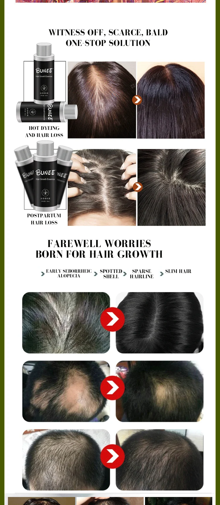 2019 New Product Olive Oil For Hair Regrowth Hair Regrowth Oil For