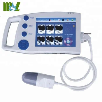 Medical Equipment Portable Bladder Scanner Bladder Scanner Price Mslpu17 View Bladder Scanner Msl Product Details From Medsinglong Co Ltd On Alibaba Com