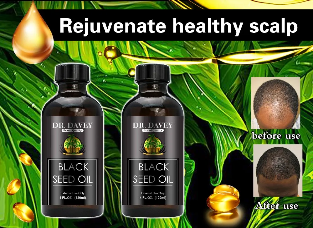 Dr.davey Jamaican Black Castor Black Seed Coconut Hair Growth Oil Oem