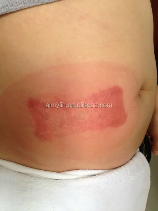 Do cherry help you lose weight photo 7