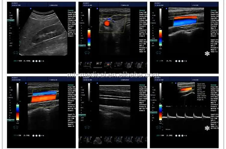 USB Ultrasound Scanner Medical Ultrasound Diagnostic System Price