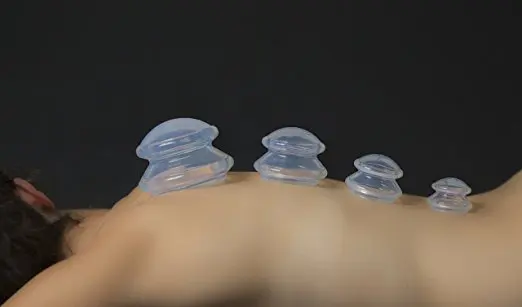4 Cup Premium Transparent Silicone Cupping Set for Chinese Cupping and Carry Bag