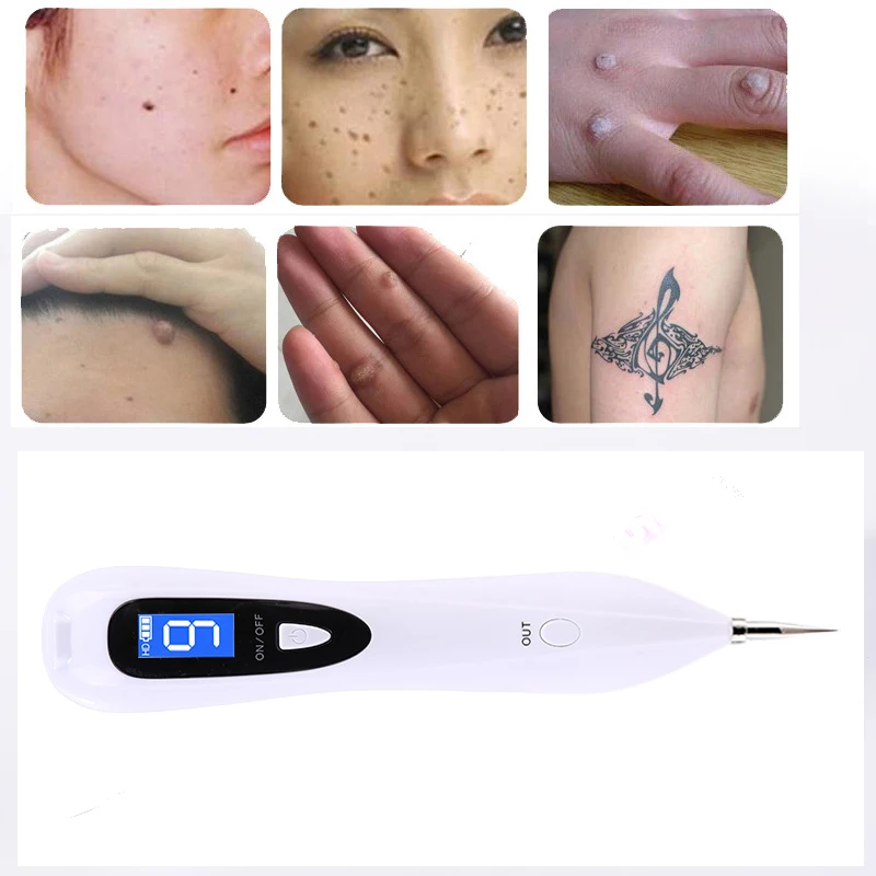 2020 Plasma Pen Skin Spot Laser Spot Removal Pen/Freckle Removal Pen/Mole Removal Machine