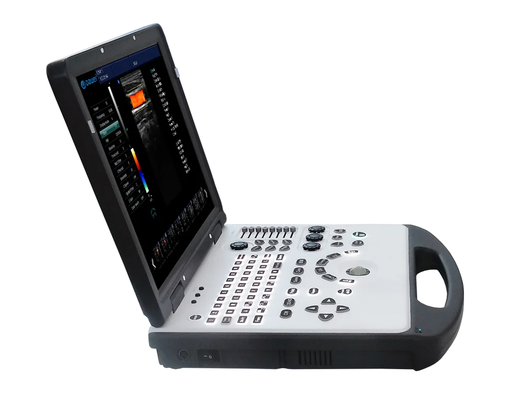 Doppler color Ultrasonido equipos portable ipad ultrasound Scanner Hospital Equipment