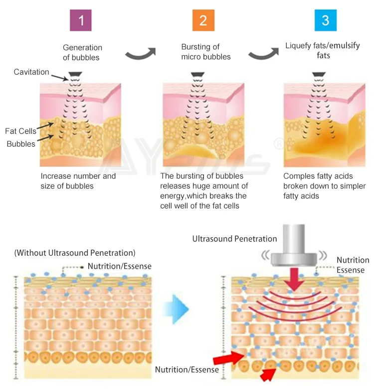 40k cavitation machine.jpg