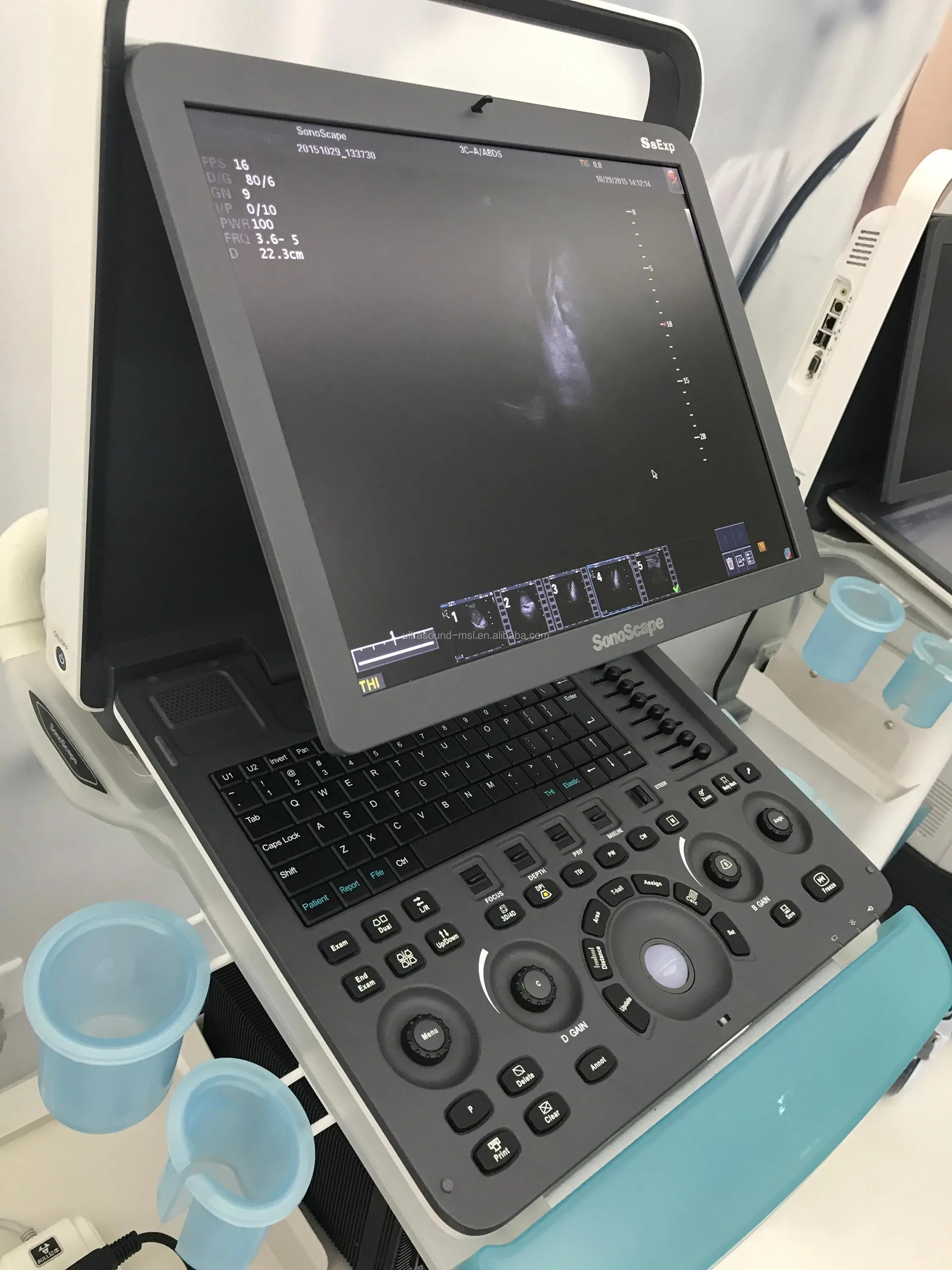 Sonoscape S8 Exp portable 2D/3D/4D ultrasound machine/ color doppler ultrasound scanner