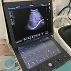Sonoscapeハイエンドsonoscape s9/s9プロ色ドップラー超音波装置システム4d/ストレスエコー/ティー最高の価格