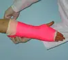 External Fixation Cover 3 Inch 4 Yard Orthopedic Fiberglass Casting Tape