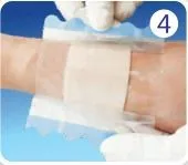 Medical consumables 5*15 cm Advanced Hydrocolloid wound patch with thin border