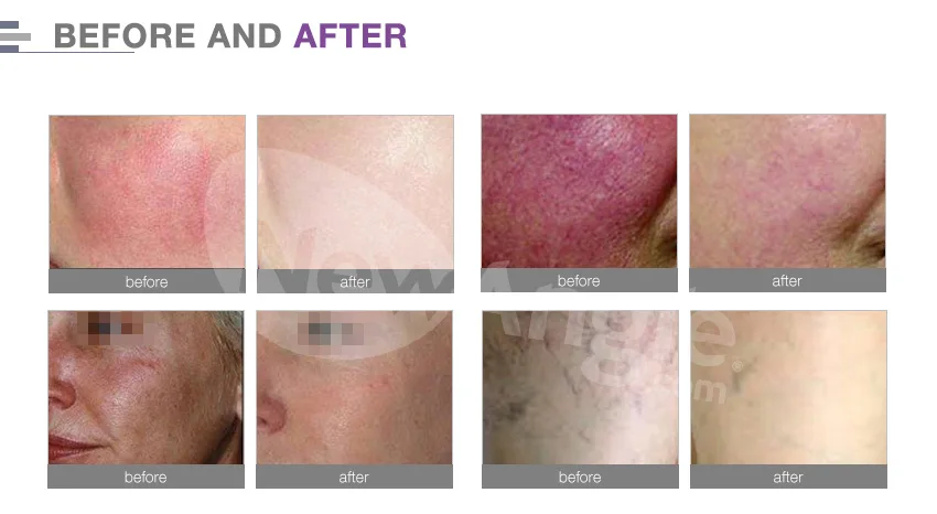 treatment effect.jpg