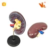 V-AM061 Medical Plastic Human Organs Kidney Anatomy Model For Teaching Use