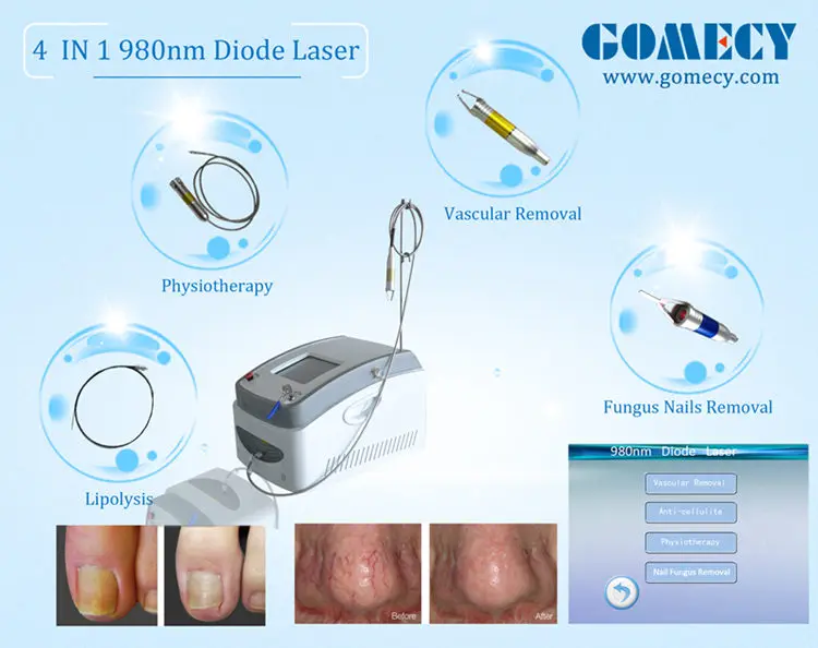 GOMECY Spider Vein Removal Machine Vascular Removal 980nm Medical Diode Laser Device.jpg