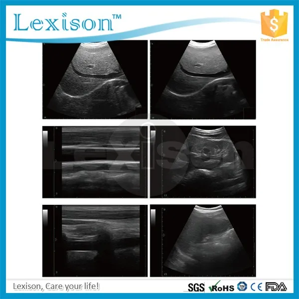 PRUS-R3000 iii LEXISON with Logo.jpg