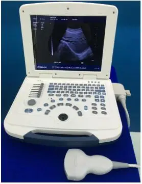 portable ultrasonic machine type 2d