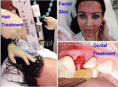 prp injection area.jpg