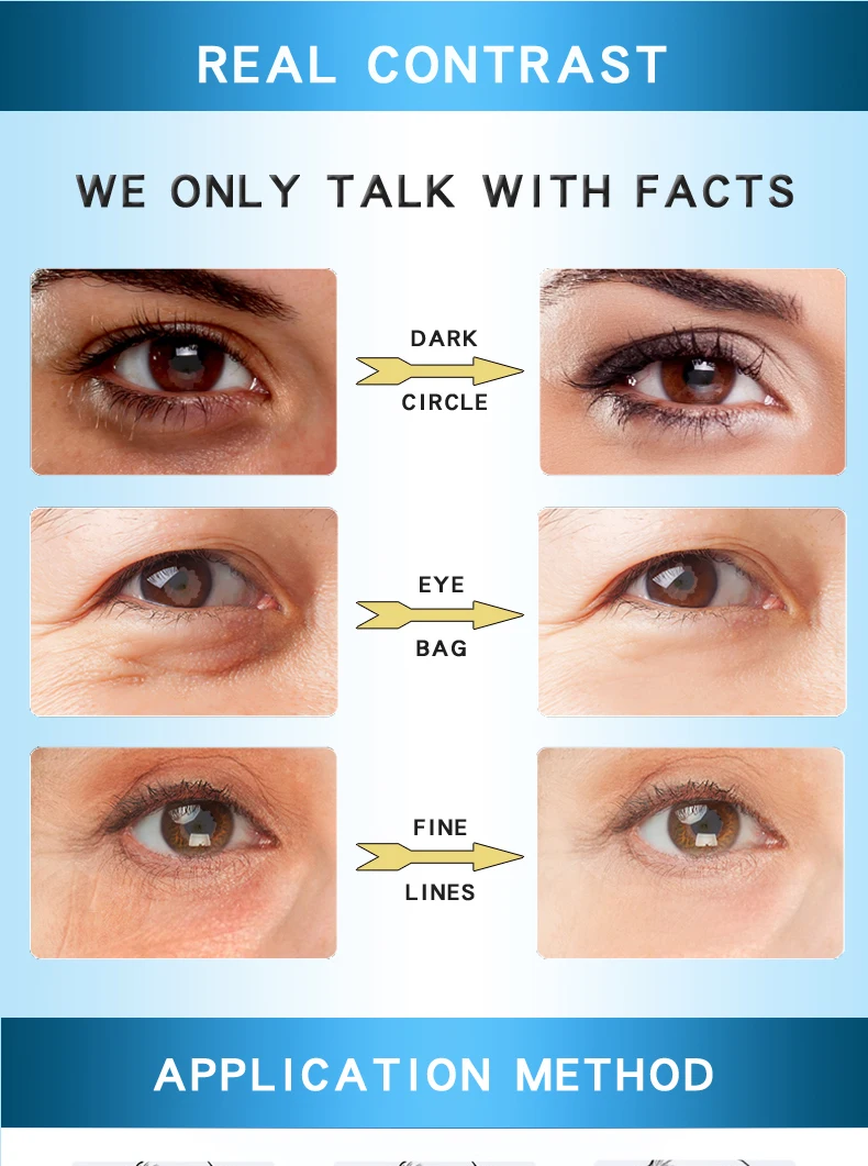 instant eye bag reducer