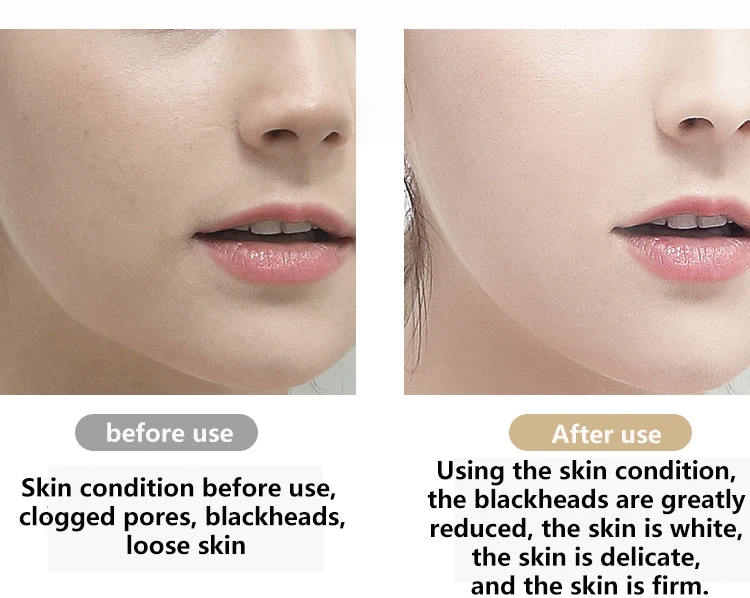 2019 Trending Product Ultrasonic Skin Scrubber Small Beauty Machine Ultrasonic Skin Spatula For Exfoliating Buy Skin Scrubber Machine Skin Scrubber Spatula Skin Scrubber Spatula Machine Product On Alibaba Com