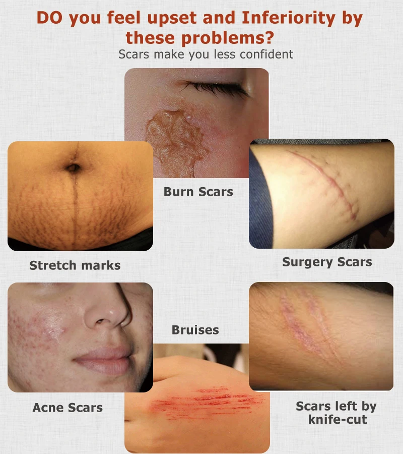 ointment for black scars