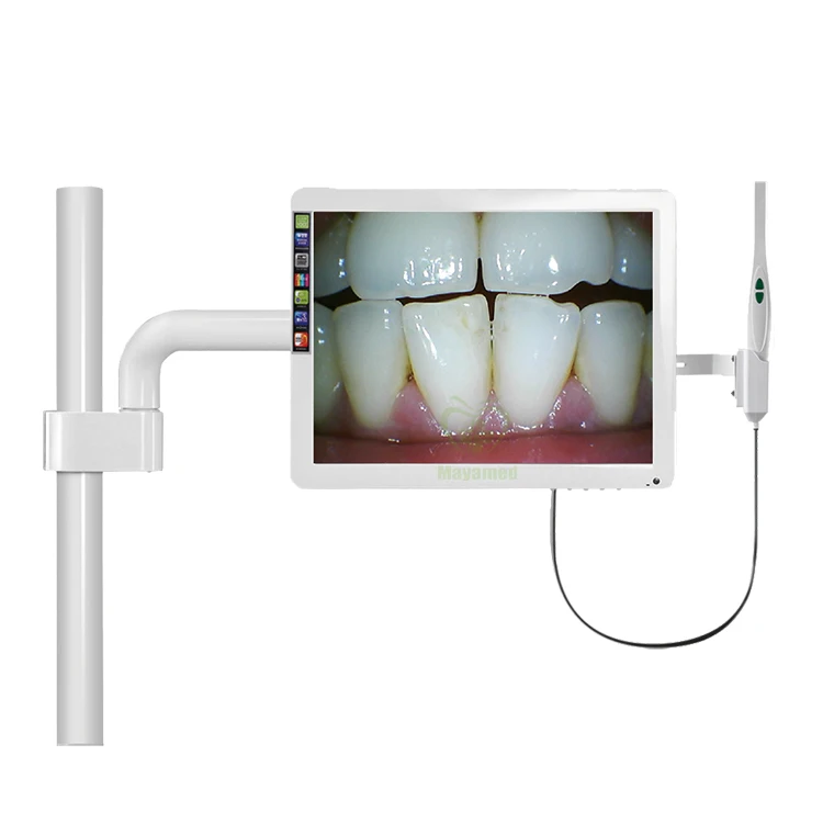 口腔内窥镜的图片