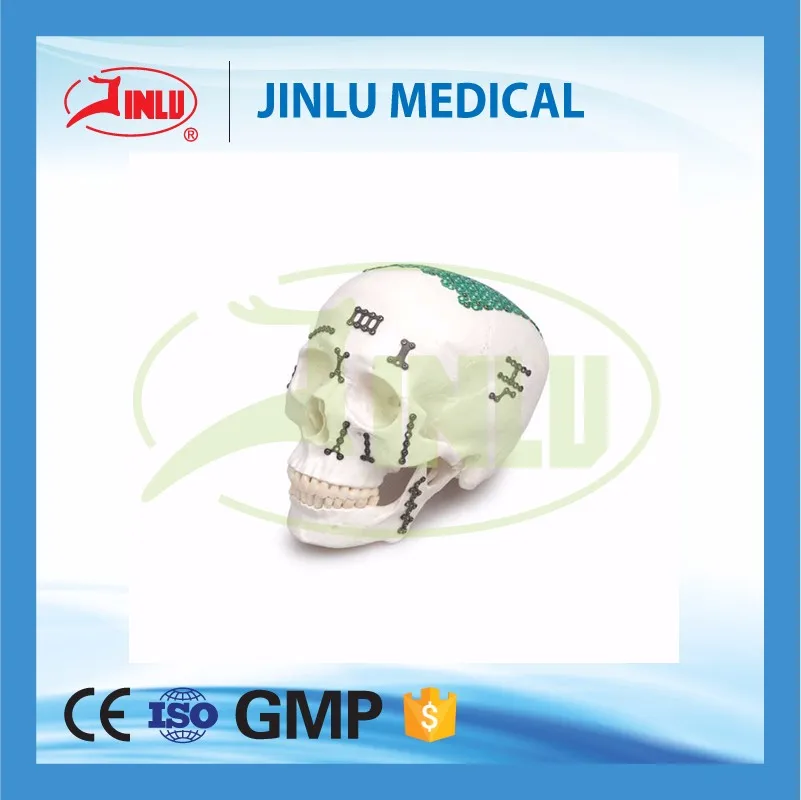 24 Hours Feedback Advanced Surface Treatment Lshaped Plate(110 Degree