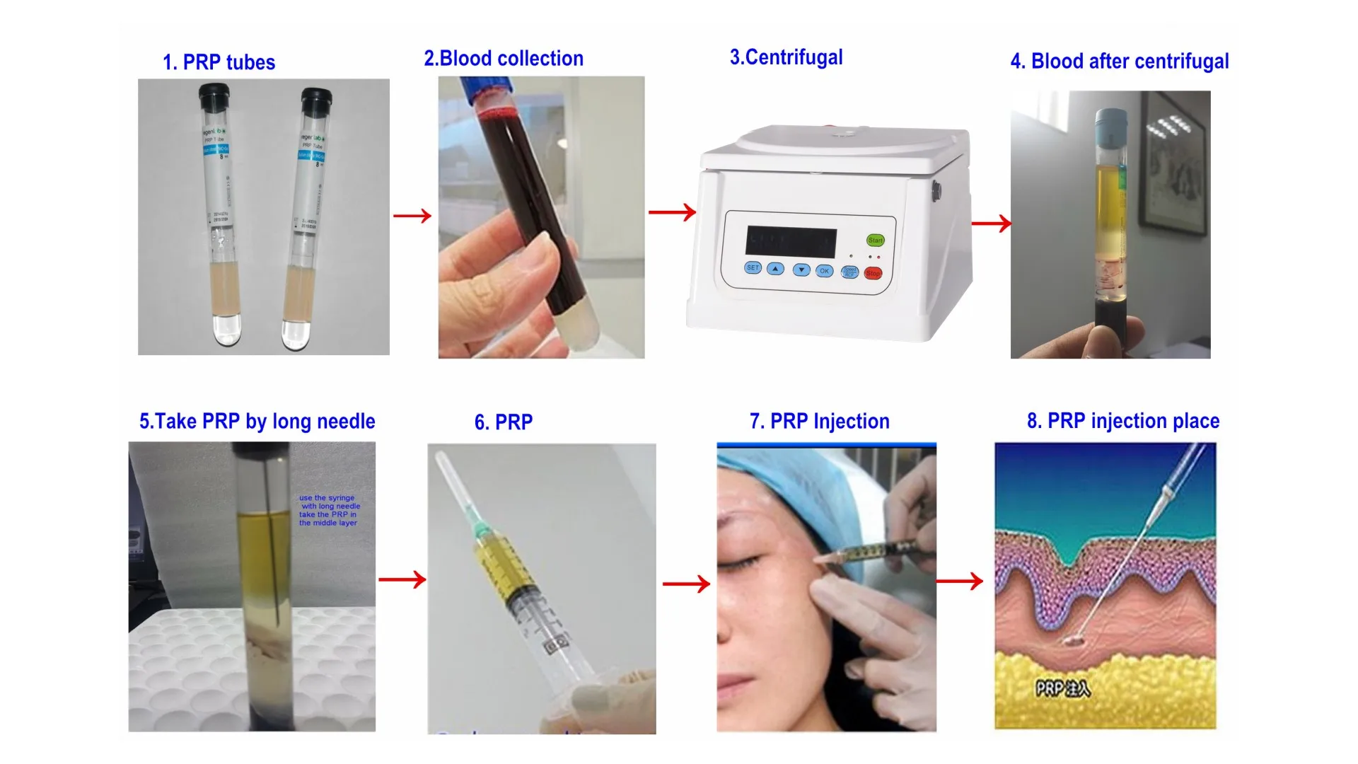 small size prp a-prf pgf cgf clinic medical centrifuge hospital