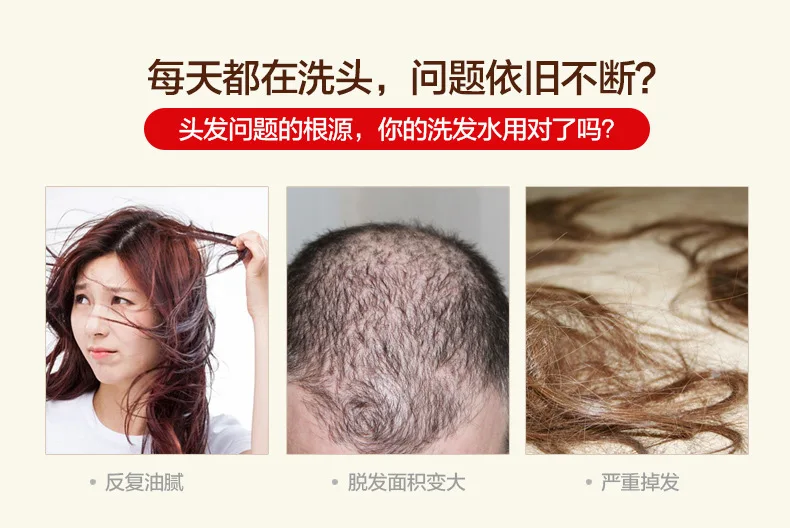 Resistência à Perda de Crescimento do Cabelo Cuidado do Cabelo Preto e Brilhante Shampoo Cabelo Tratamento Profissão Mostrando Suave 2 Cabelo Cabelo Preto E Brilhante Suave