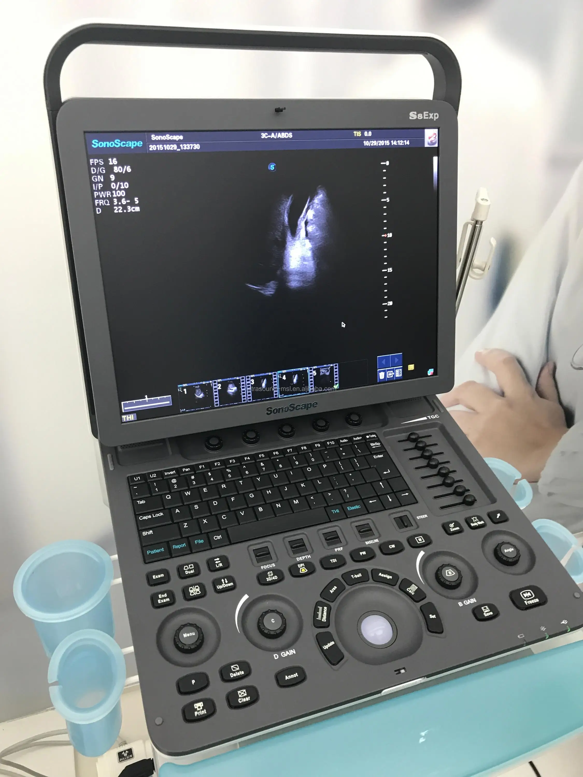 Sonoscape S8 Exp portable 2D/3D/4D ultrasound machine/ color doppler ultrasound scanner