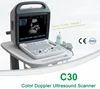 Super image quality portable vascular doppler / Economical and practical doppler ultrasound price C30