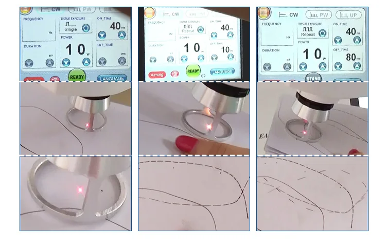 30W medical laser system portable fractional co2 laser