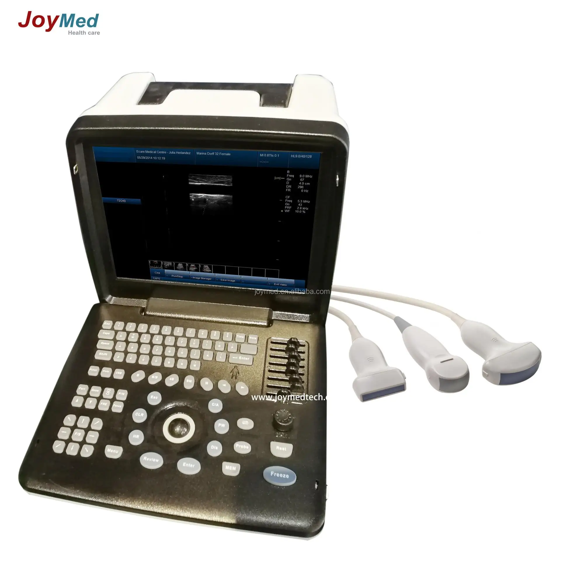 New Model Portable B Mode Ultrasound Scanner 12inch Led Ultrasound ...