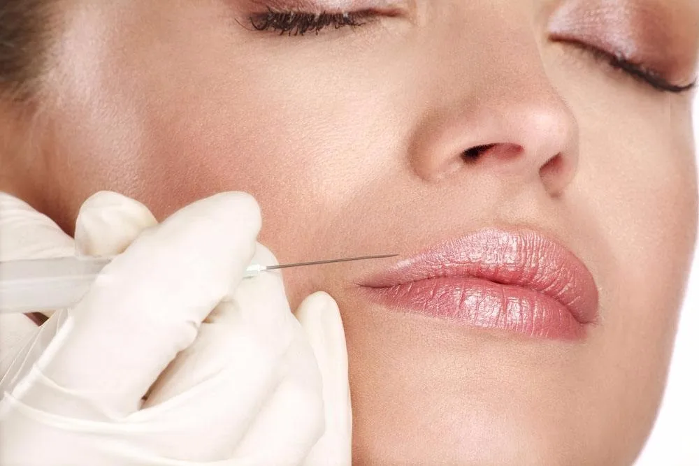 super deep lines dermal filler injection facial wr