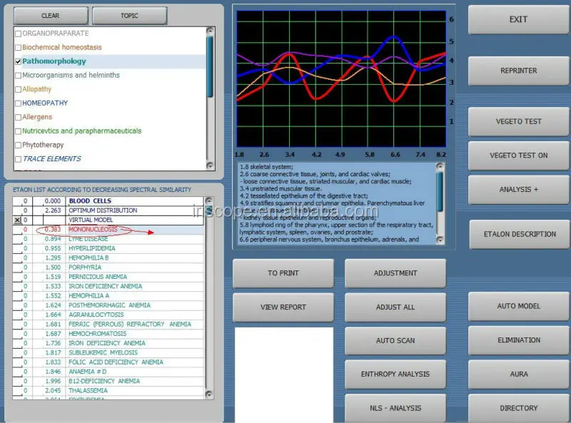 Aura Detection Software