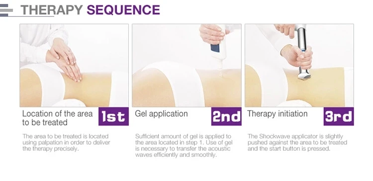 Physical therapy shockwave/focus shockwave therapy/acoustic wave therapy SW9