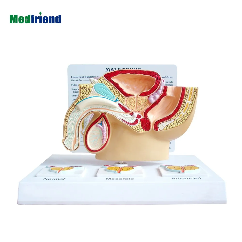 3 pcs prostate model - buy 先进的解剖男性骨盆模型 3 个前列腺