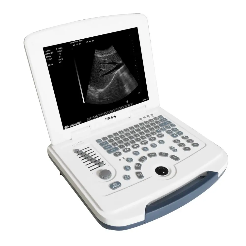 Portable Medical Notebook Digital Diagnostic Ultrasound Scanner Machine USS-N580