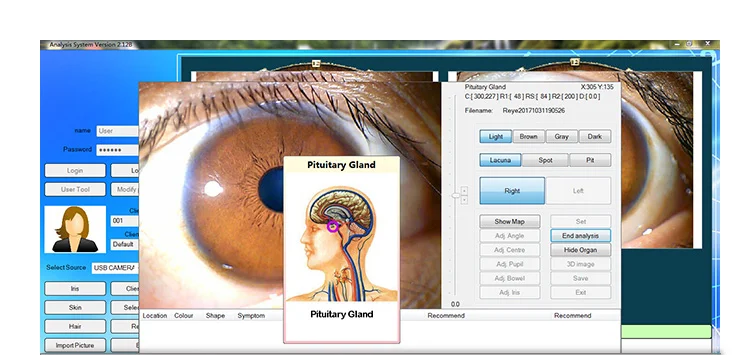 best body scanner machine spanish biometric eye iris iridology iriscope camera/cameras equipment for health digital analysis